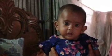 ভালুকায় ৫ মাসের শিশু সামিয়াকে বাঁচাতে অসহায় বাবার আকুতি