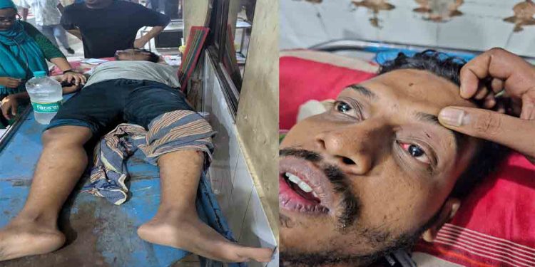 ফিক্সড-মিল নির্ধারণ নিয়ে ইবি শিক্ষার্থীদের মারামারি, আহত ৪