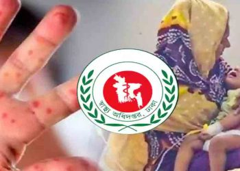 হাম ও হামের উপসর্গে আরও ৭ শিশুর মৃত্যু