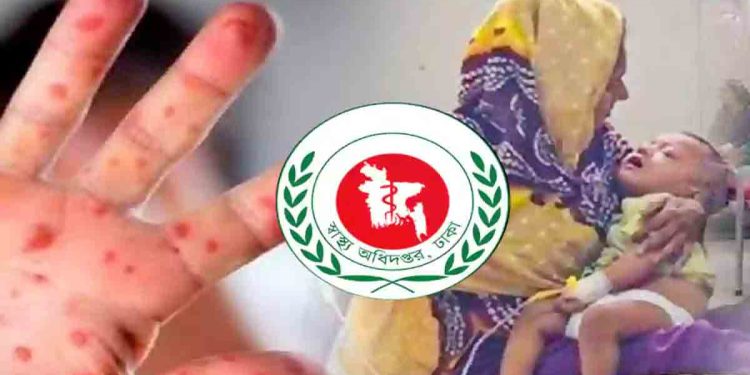 হাম ও হামের উপসর্গে আরও ৭ শিশুর মৃত্যু