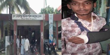 চোর সন্দেহে আটক, শারীরিক নির্যাতন করে হাত ভেঙে দেওয়ার অভিযোগ উঠছে ইউপি চেয়ারম্যানের বিরুদ্ধে